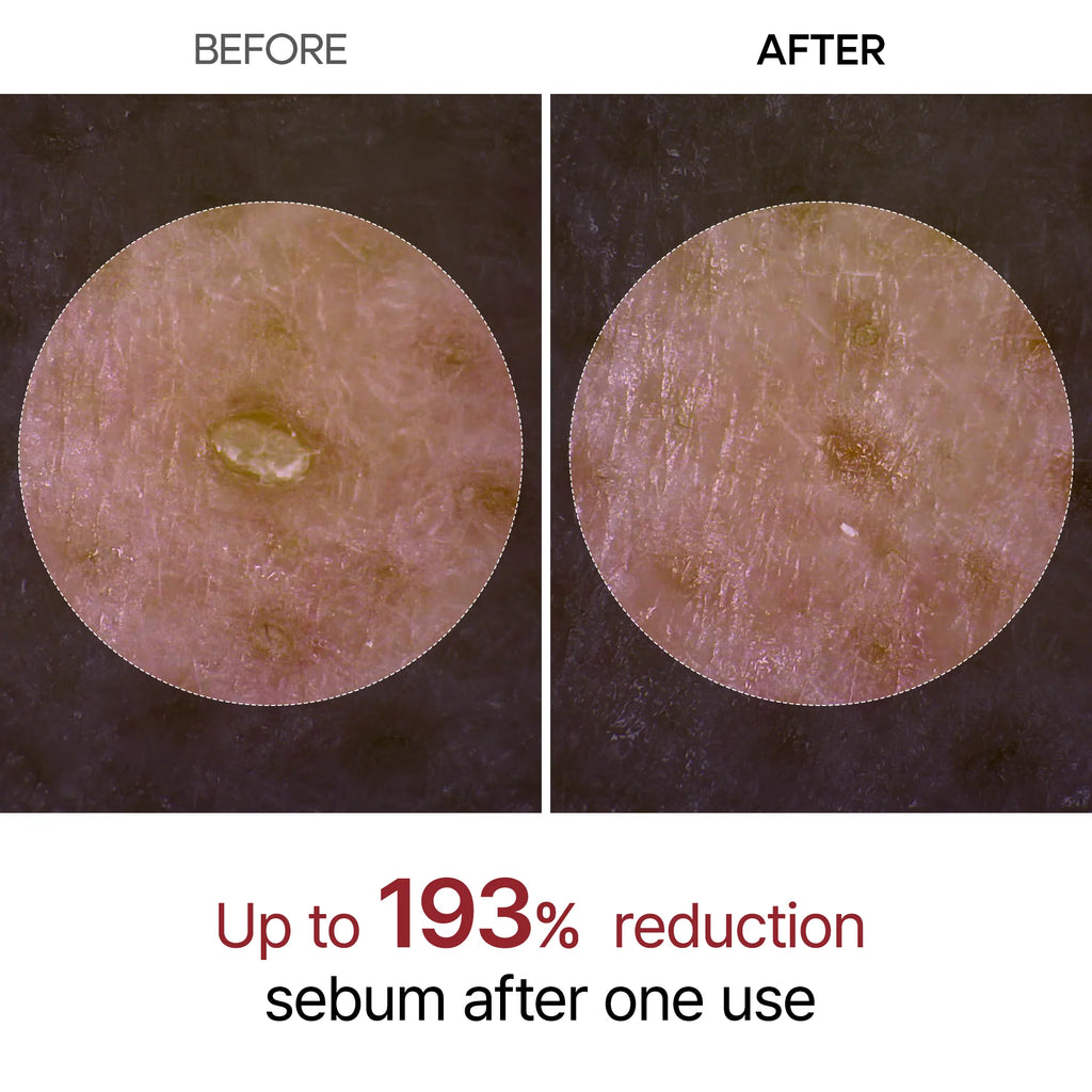 DR. MELAXIN  PeelShot Glow Black Rice Ampoule