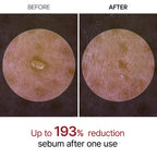 DR. MELAXIN  PeelShot Glow Black Rice Ampoule