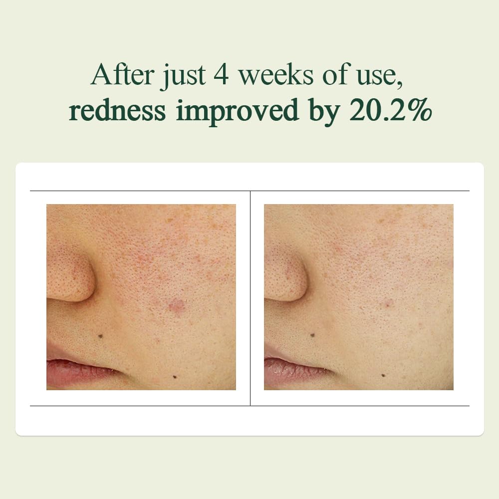 Calming Madecasoside Spot Cream 30ml