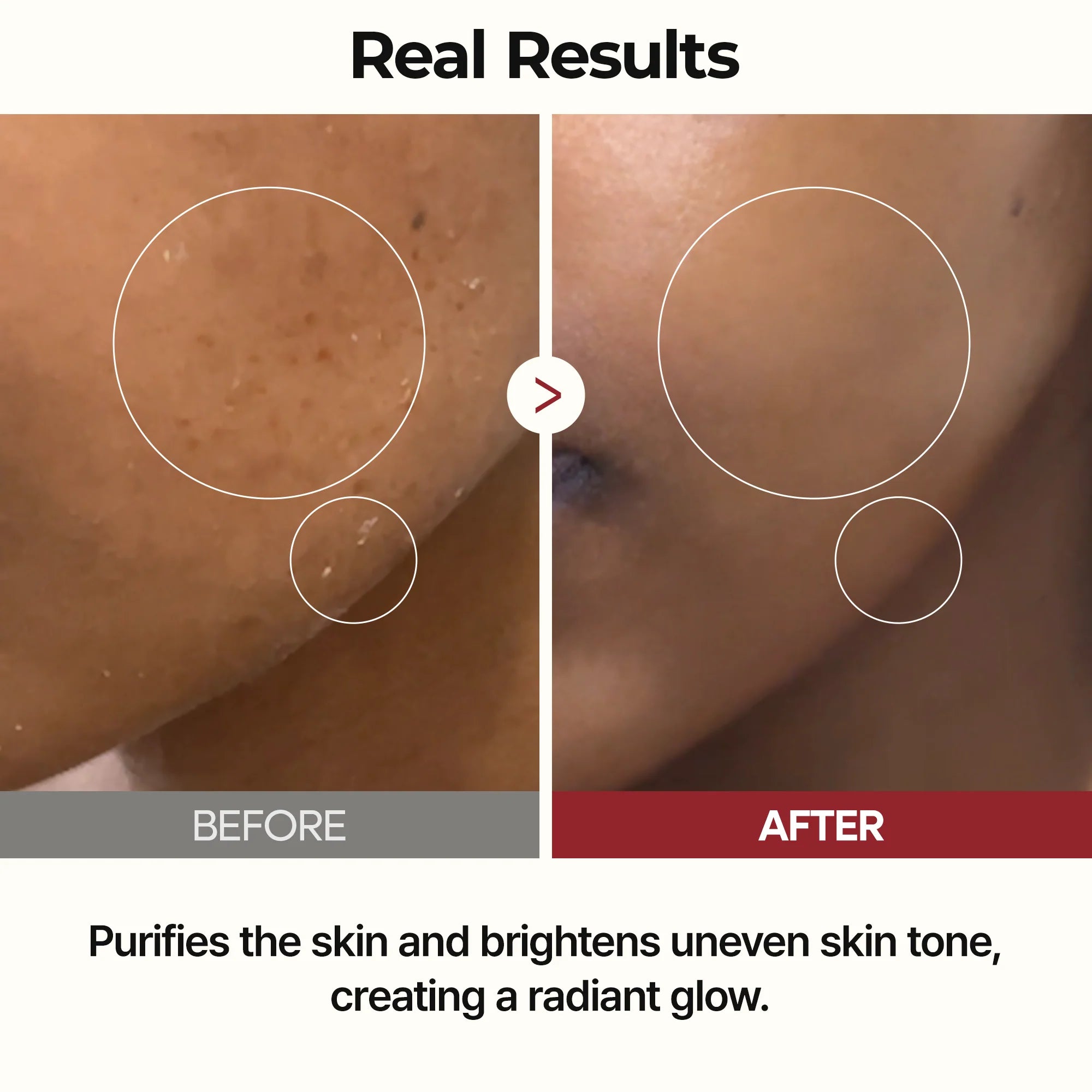 DR. MELAXIN  PeelShot Glow Black Rice Ampoule