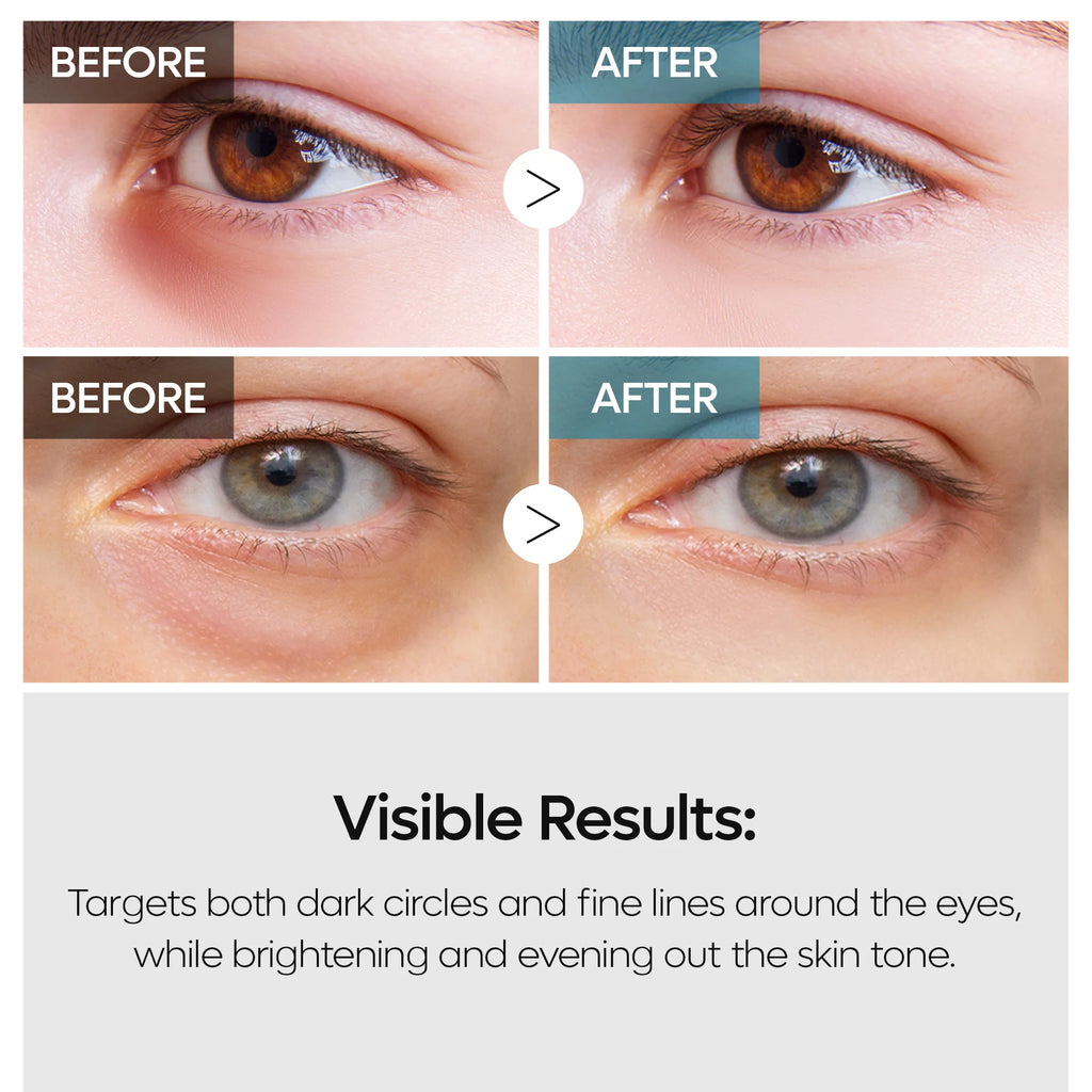 TX Retinalsome Double Effect Eye Cream