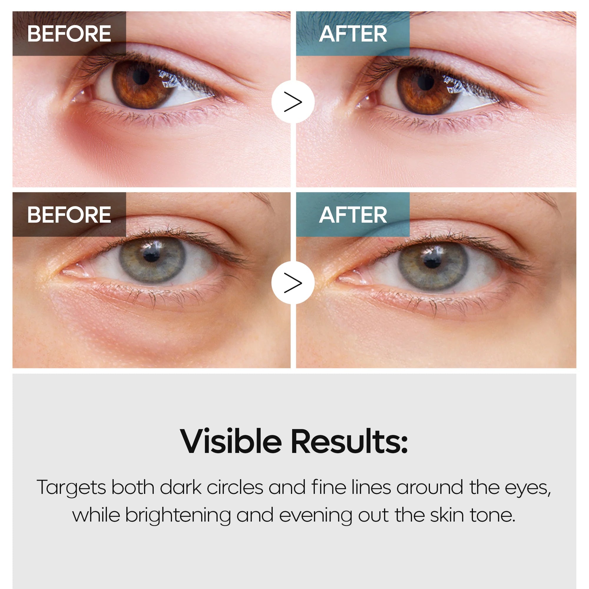 TX Retinalsome Double Effect Eye Cream
